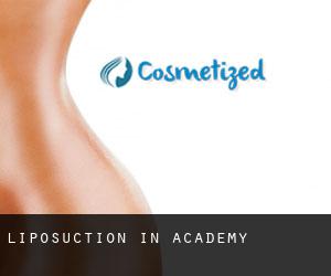 Liposuction in Academy