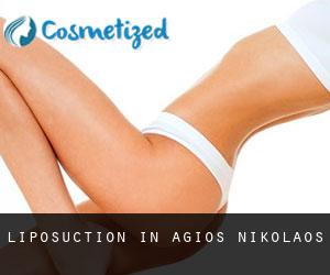 Liposuction in Agios Nikolaos