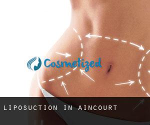 Liposuction in Aincourt