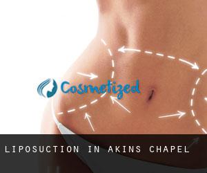 Liposuction in Akins Chapel