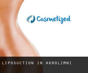 Liposuction in Akrolímni