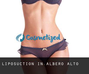 Liposuction in Albero Alto
