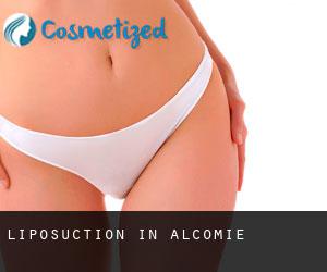 Liposuction in Alcomie