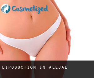 Liposuction in Alejal