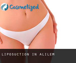 Liposuction in Alilem