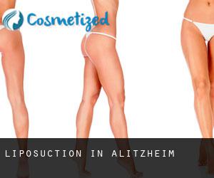 Liposuction in Alitzheim