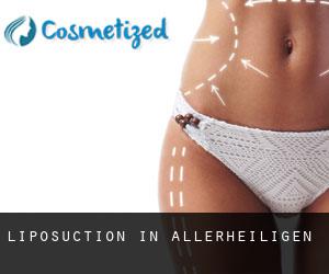 Liposuction in Allerheiligen