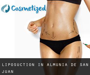 Liposuction in Almunia de San Juan
