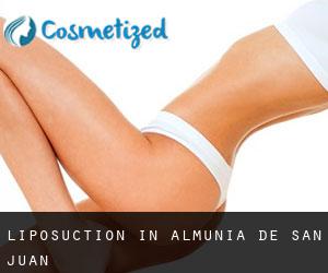 Liposuction in Almunia de San Juan