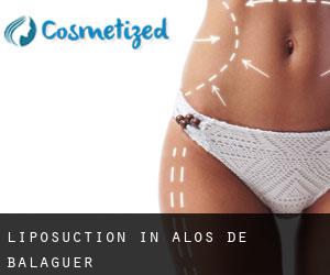 Liposuction in Alòs de Balaguer