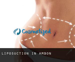 Liposuction in Ambon