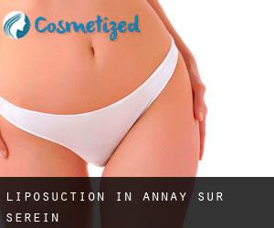 Liposuction in Annay-sur-Serein