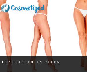 Liposuction in Arçon