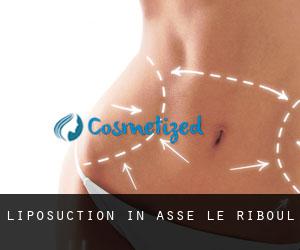 Liposuction in Assé-le-Riboul