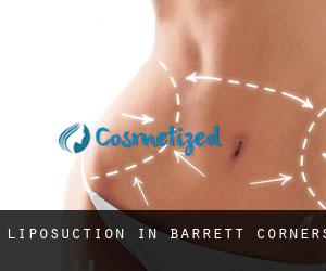 Liposuction in Barrett Corners