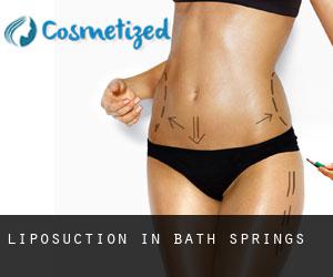 Liposuction in Bath Springs