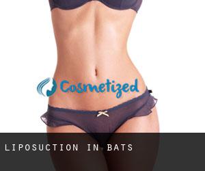 Liposuction in Bats