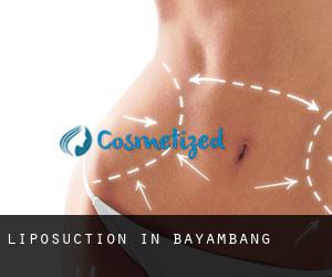 Liposuction in Bayambang
