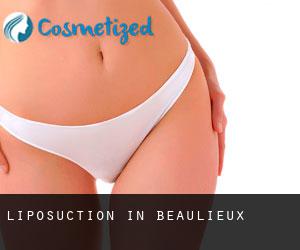 Liposuction in Beaulieux