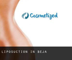 Liposuction in Beja