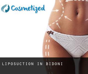 Liposuction in Bidonì