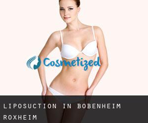 Liposuction in Bobenheim-Roxheim