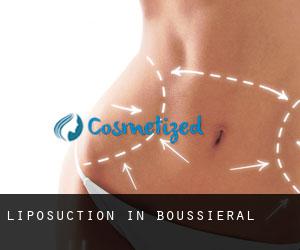 Liposuction in Boussiéral