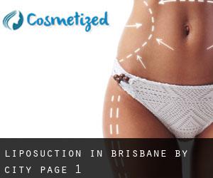 Liposuction in Brisbane by city - page 1