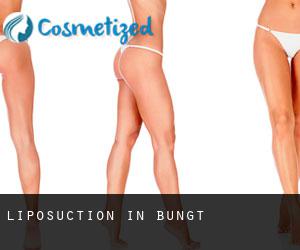 Liposuction in Bungt