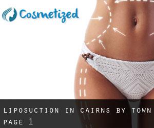 Liposuction in Cairns by town - page 1