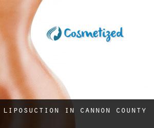 Liposuction in Cannon County