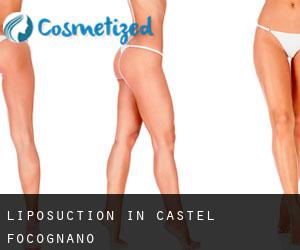 Liposuction in Castel Focognano