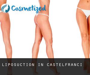 Liposuction in Castelfranci