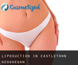 Liposuction in Castletown Geoghegan