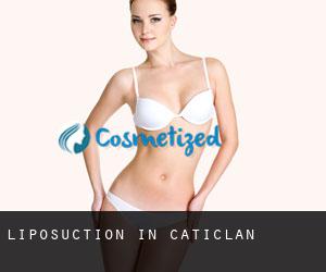 Liposuction in Caticlan