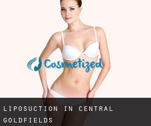 Liposuction in Central Goldfields