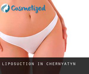 Liposuction in Chernyatyn