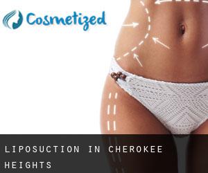 Liposuction in Cherokee Heights