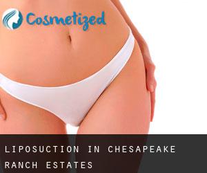 Liposuction in Chesapeake Ranch Estates