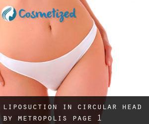 Liposuction in Circular Head by metropolis - page 1