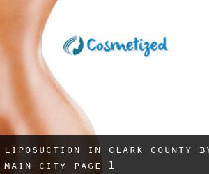 Liposuction in Clark County by main city - page 1