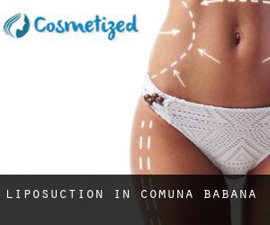 Liposuction in Comuna Băbana