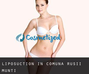 Liposuction in Comuna Ruşii Munţi