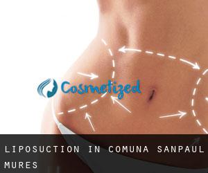 Liposuction in Comuna Sânpaul (Mureş)