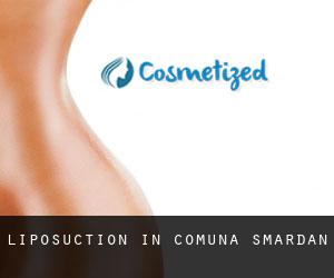 Liposuction in Comuna Smârdan