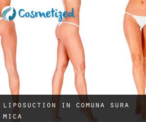 Liposuction in Comuna Şura Mică