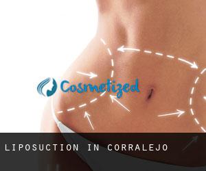 Liposuction in Corralejo