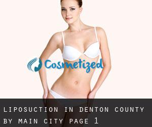 Liposuction in Denton County by main city - page 1