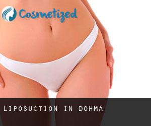 Liposuction in Dohma