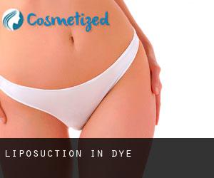 Liposuction in Dye